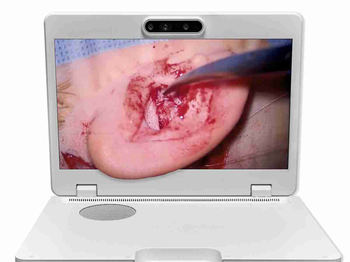 达擎之＂Heads-up 3D显微手术显示系统＂，，，整合4K裸眼3D显示及眼球追踪系统，，，，具备快速追踪人眼移动位置功能，，减轻医师长时间维持固定姿势的负担，，，，让医师能有更宽广清晰的3D立体视野及更舒适的姿势来执行手术。。